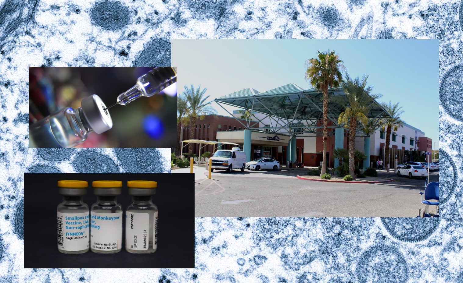 Monkeypox Found In Imperial County Holtville Tribune